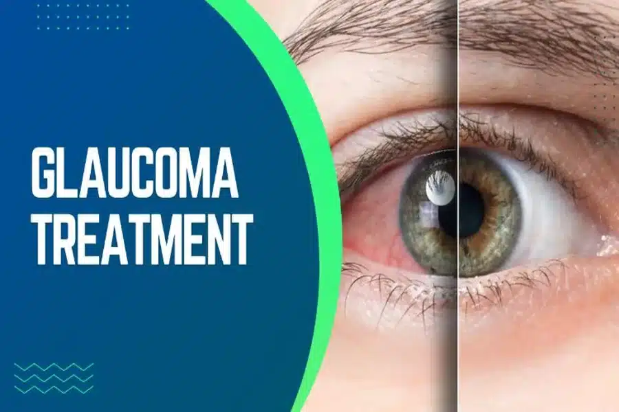 Glaucoma Treatment Options